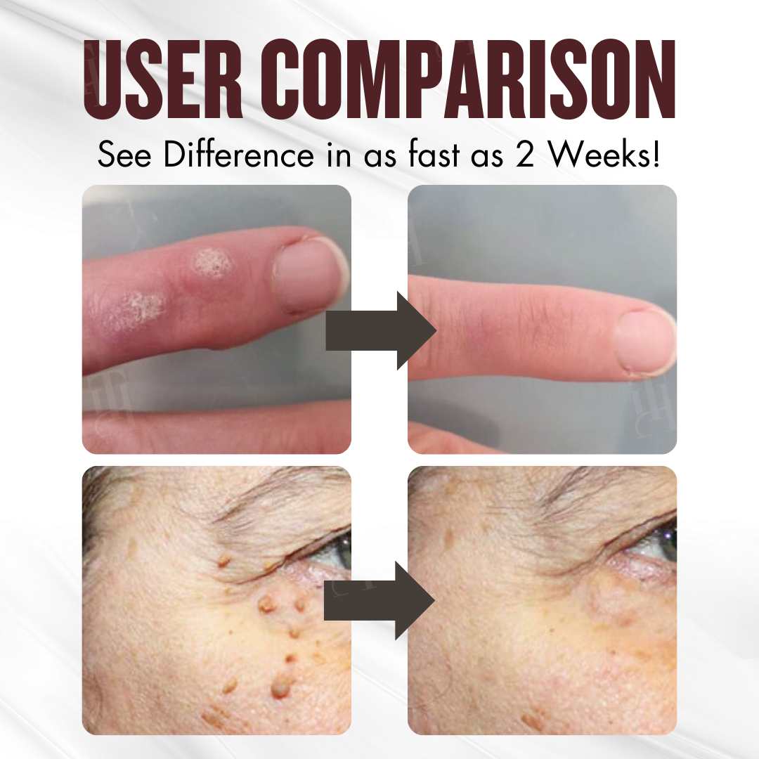 BLACK FRIDAY 40% OFF | Cvreoz® All-in-1 Ceramide Skin Cream