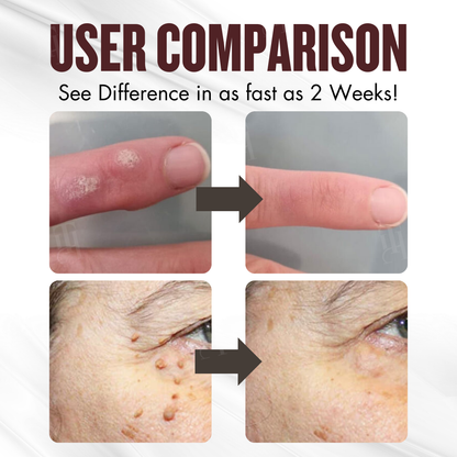 BLACK FRIDAY 40% OFF | Cvreoz® All-in-1 Ceramide Skin Cream