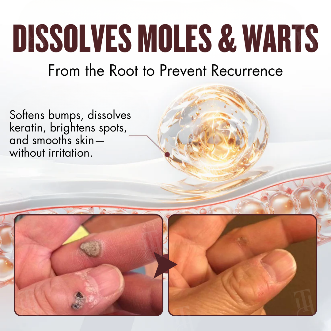 BLACK FRIDAY 40% OFF | Cvreoz® All-in-1 Ceramide Skin Cream