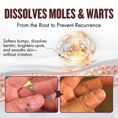 BLACK FRIDAY 40% OFF | Cvreoz® All-in-1 Ceramide Skin Cream