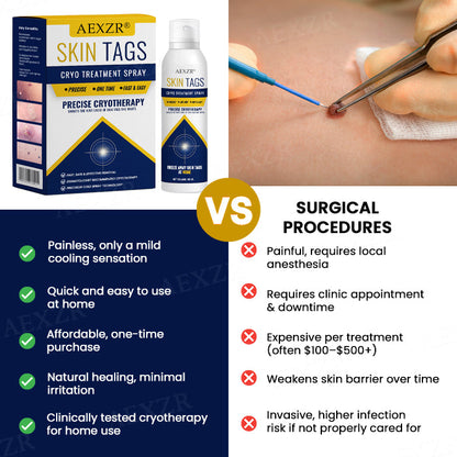BLACK FRIDAY 40% OFF | AEXZR® Skin Tag Cryo Treatment Spray