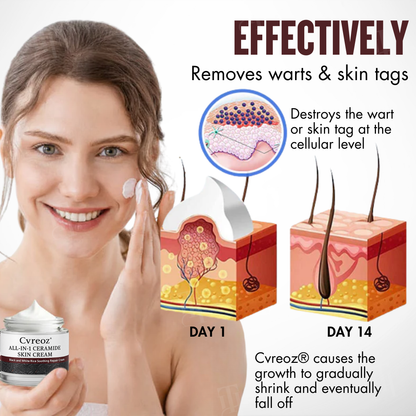 BLACK FRIDAY 40% OFF | Cvreoz® All-in-1 Ceramide Skin Cream