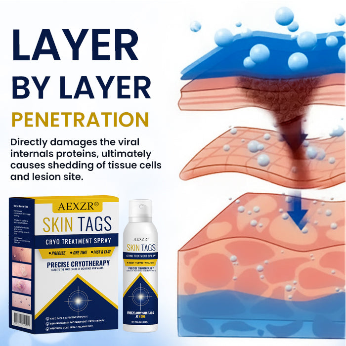 BLACK FRIDAY 40% OFF | AEXZR® Skin Tag Cryo Treatment Spray